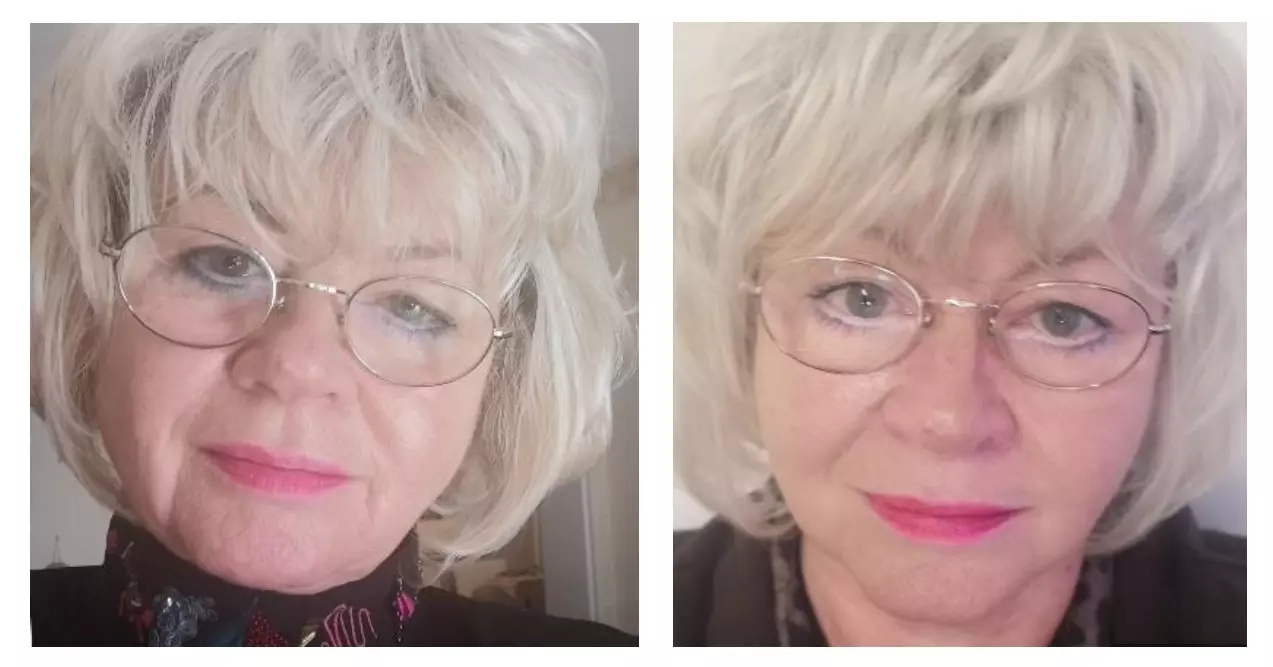Anti-Aging Gesichzsbehandlung