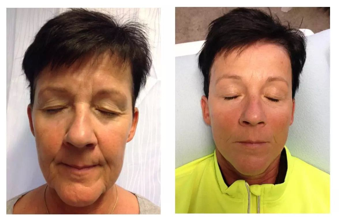Anti-Aging Gesichtsbehandlung