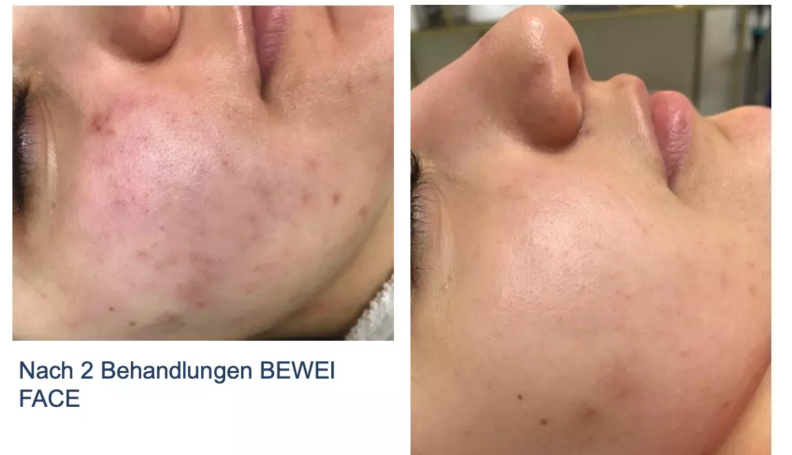 Hautbild verbessern